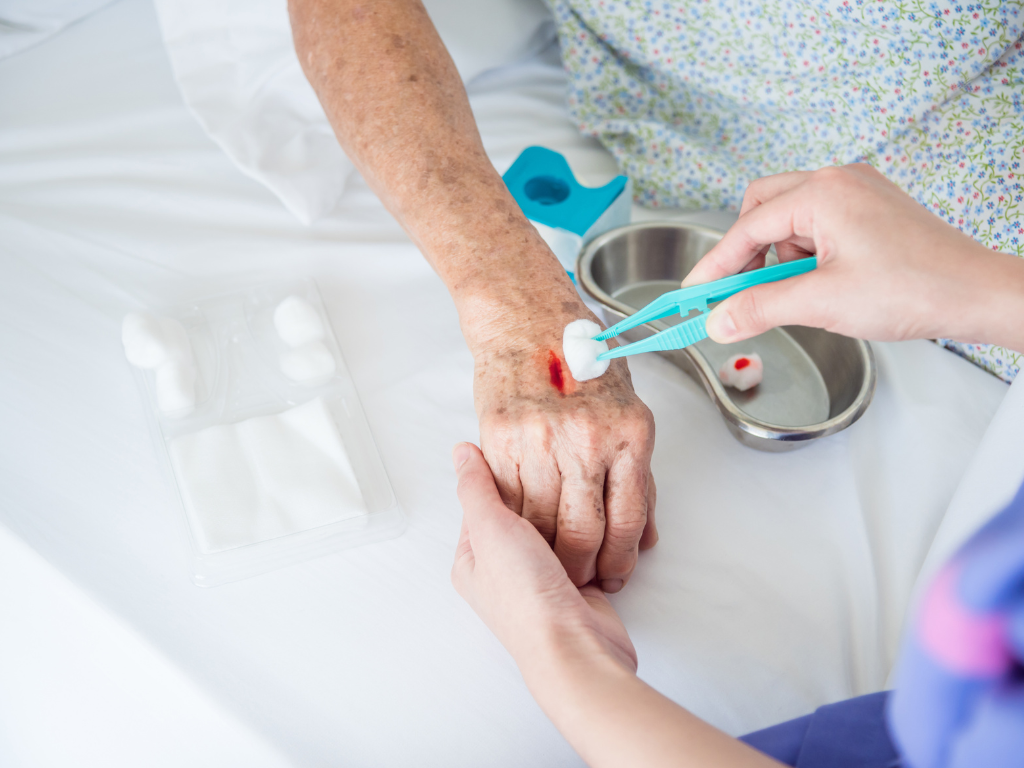 Professionelle Wundpflege durch erfahrene Wundmanagerin bei Hausbesuch in Wien und Gänserndorf