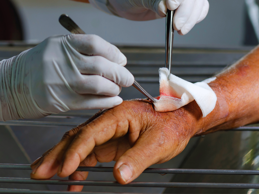 Professionelle Wundpflege durch erfahrene Wundmanagerin bei Hausbesuch in Wien und Gänserndorf